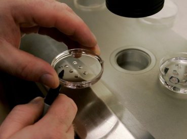 Científicos crean “híbridos” de hombre y oveja para cultivar órganos para trasplante