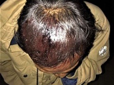 Seis cristianos heridos por lapidación en culto navideño