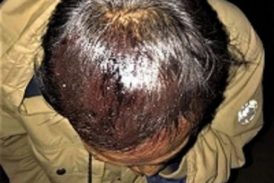 Seis cristianos heridos por lapidación en culto navideño